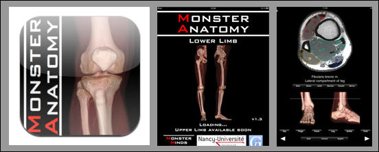 Monster Anatomy HD - Lower Limb