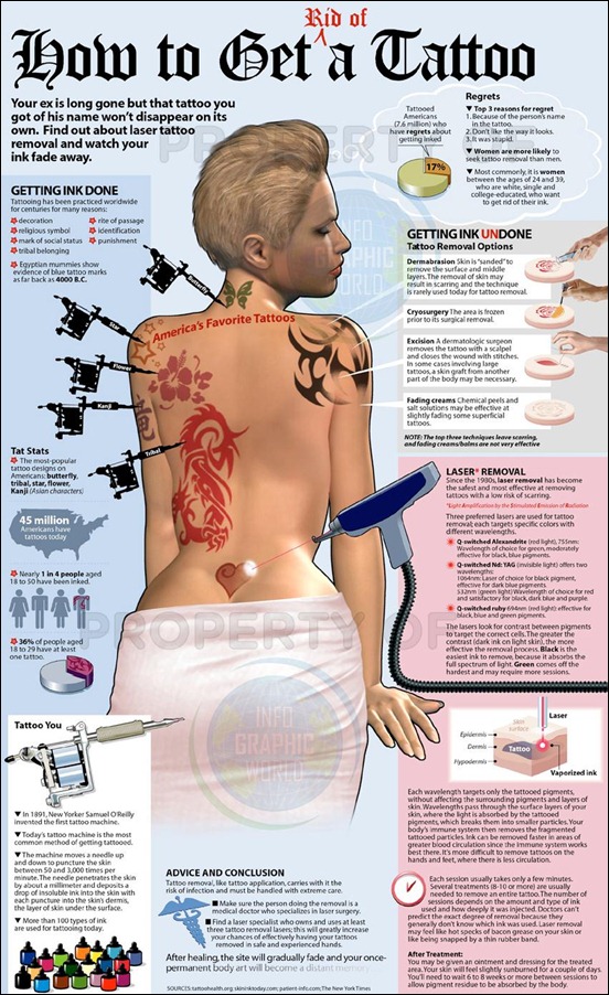 guide-to-tattoo-removal